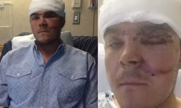 'Tive que enfiar um braço na garganta dele': caçador sobrevive a ataque de urso de 180 kg com manobra inusitada