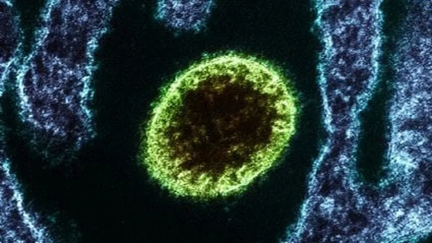 Vírus letal Nipah coloca Índia em alerta após confirmação de casos em profissionais de saúde