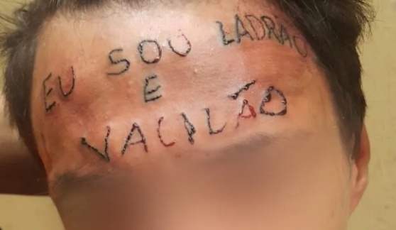 Jovem que teve testa tatuada com frase 'eu sou ladrão e vacilão' é preso após furtar unidade de saúde em Diadema