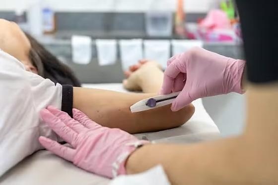 Cuiabá passa a oferecer chip anticoncepcional pelo SUS
