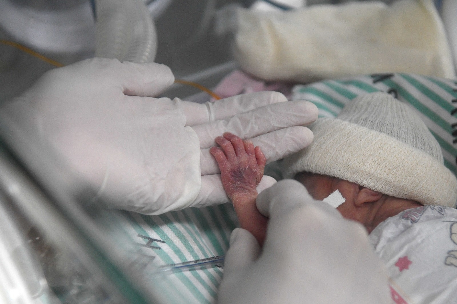 A estratégia de Mato Grosso para que bebês recebam Nirsevimabe