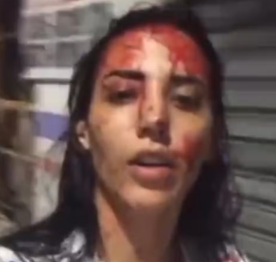 Mulher é detida por esfaquear namorado e alega que sofria violência doméstica em Maceió