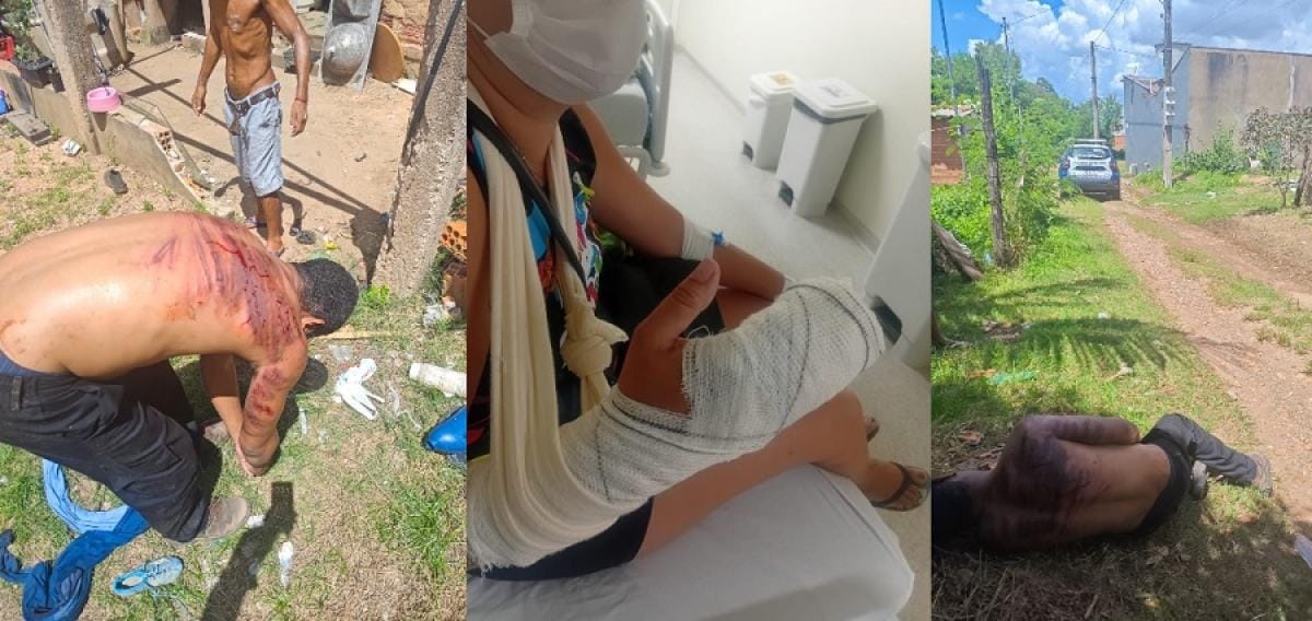 Agressor que arrancou dedos da mulher com golpes de faca leva 'salve' de facção e é preso