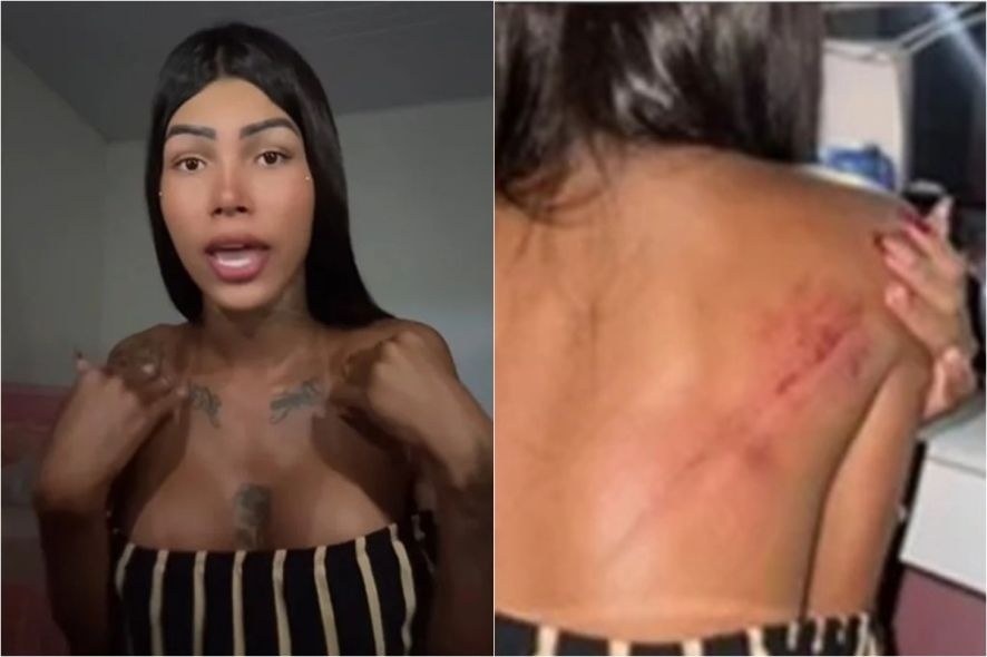 Garota de programa é agredida por esposa de cliente em motel