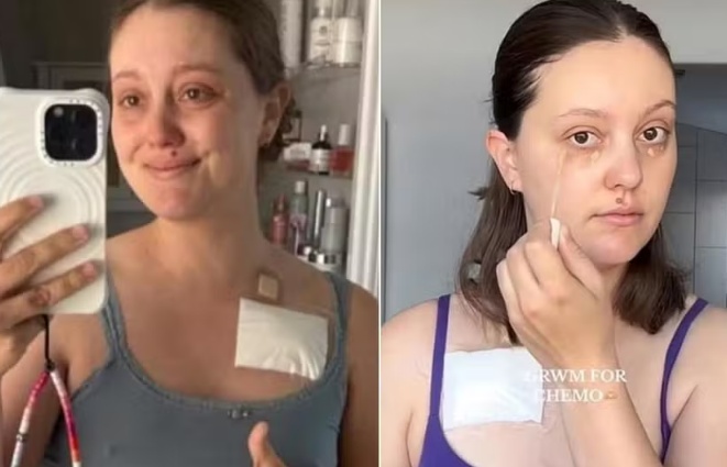 Mulher finge ter câncer de pâncreas e arrecada R$ 100 mil