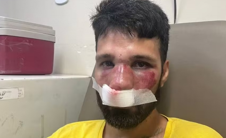 No dia do aniversário, DJ é confundido com ladrão de bicicleta e espancado por entregadores no RJ