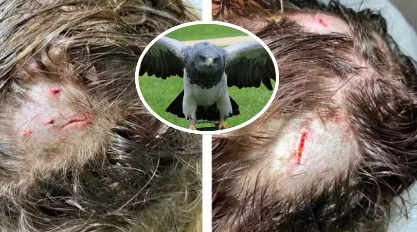 Primeiro ataque de harpia a humano já documentado ocorreu na Amazônia e acende alerta sobre perseguição à espécie