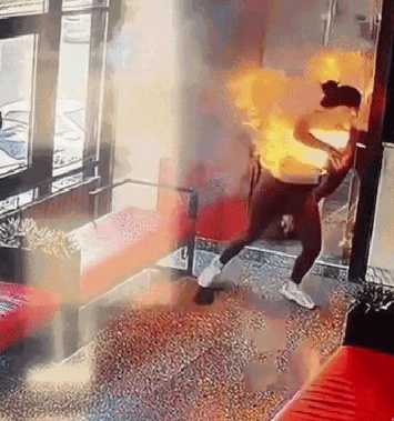 Carregador portátil explode dentro de bolsa e deixa influencer com sérias queimaduras