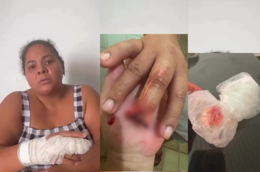 Mulher tem parte de dedo amputado após maca ceder em posto de saúde de Cuiabá