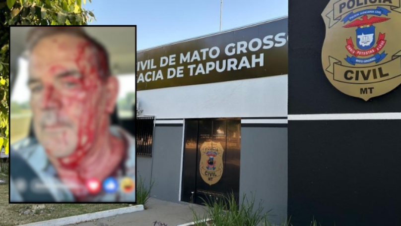 Briga em restaurante deixa ex-prefeito de MT coberto de sangue